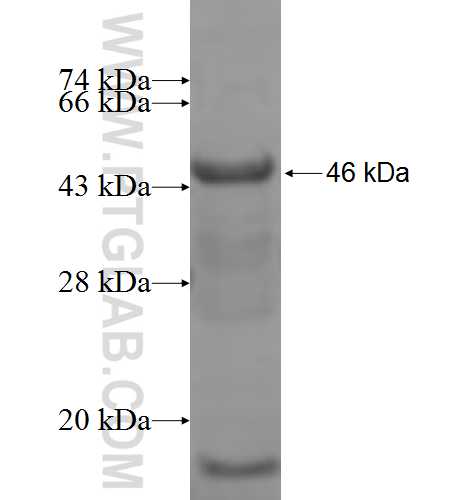 MCCC1 fusion protein Ag6789 SDS-PAGE