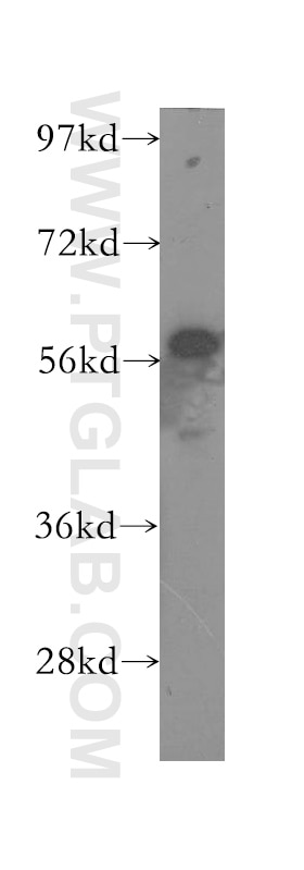 Western Blot (WB) analysis of human liver tissue using MCCC2 Polyclonal antibody (12117-1-AP)