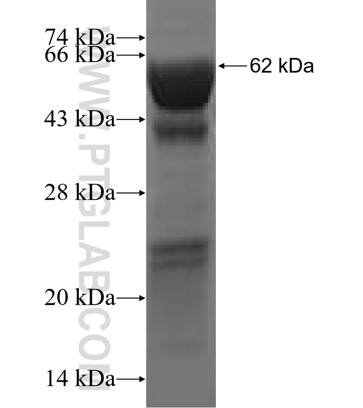 MCCC2 fusion protein Ag2767 SDS-PAGE