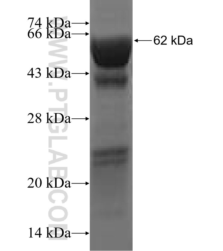 MCCC2 fusion protein Ag2767 SDS-PAGE