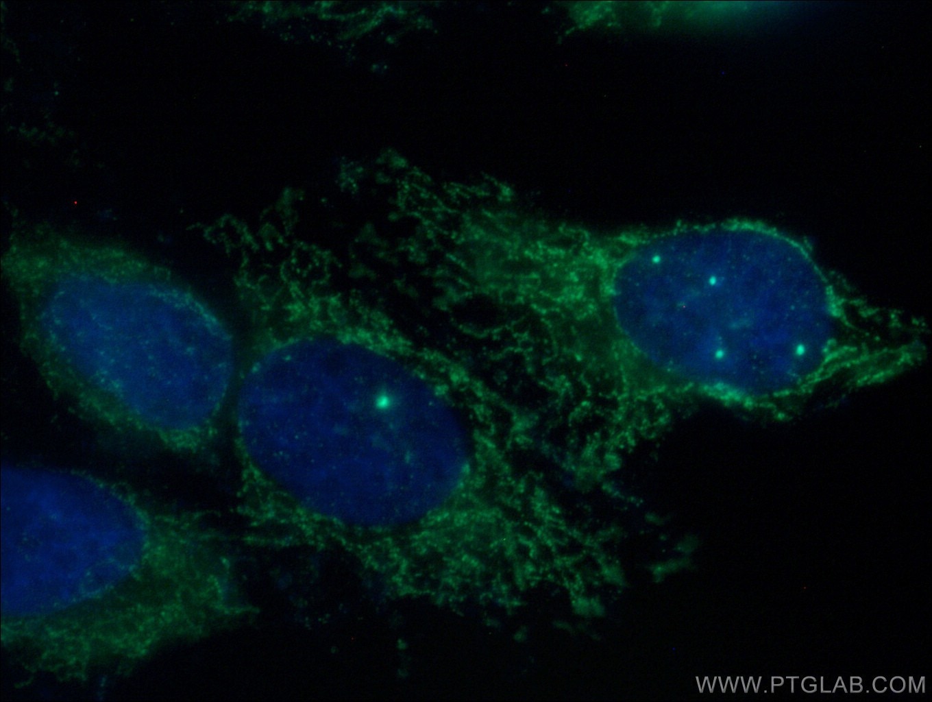 Immunofluorescence (IF) / fluorescent staining of HepG2 cells using MCEE Polyclonal antibody (16499-1-AP)