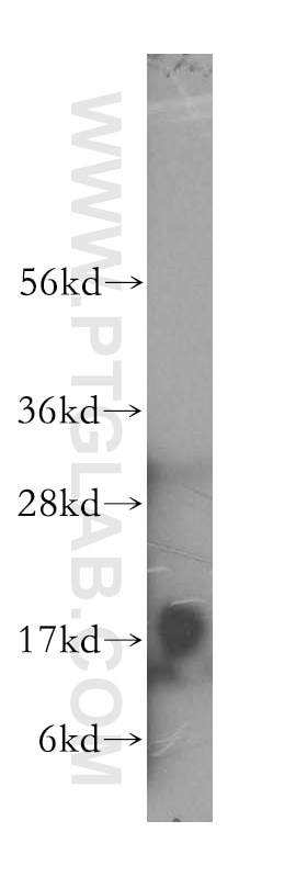 Western Blot (WB) analysis of human heart tissue using MCEE Polyclonal antibody (16499-1-AP)