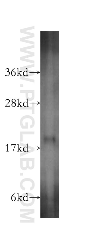 Western Blot (WB) analysis of human liver tissue using MCEE Polyclonal antibody (16499-1-AP)