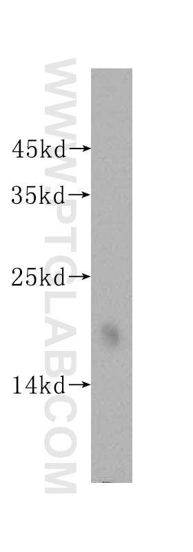 Western Blot (WB) analysis of human heart tissue using MCEE Polyclonal antibody (16499-1-AP)