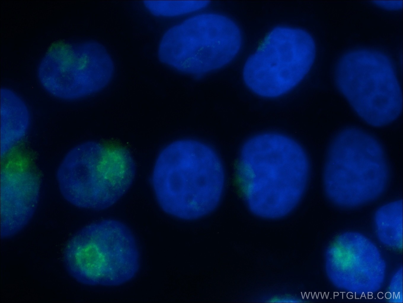 Immunofluorescence (IF) / fluorescent staining of HeLa cells using MCFD2 Polyclonal antibody (13068-1-AP)