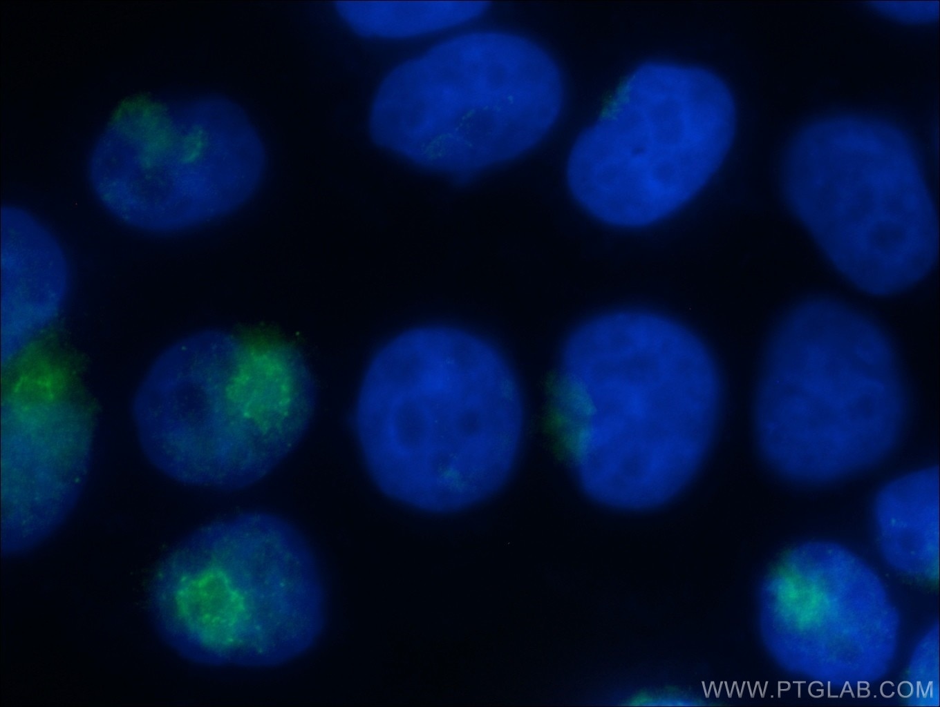 IF Staining of HeLa using 13068-1-AP