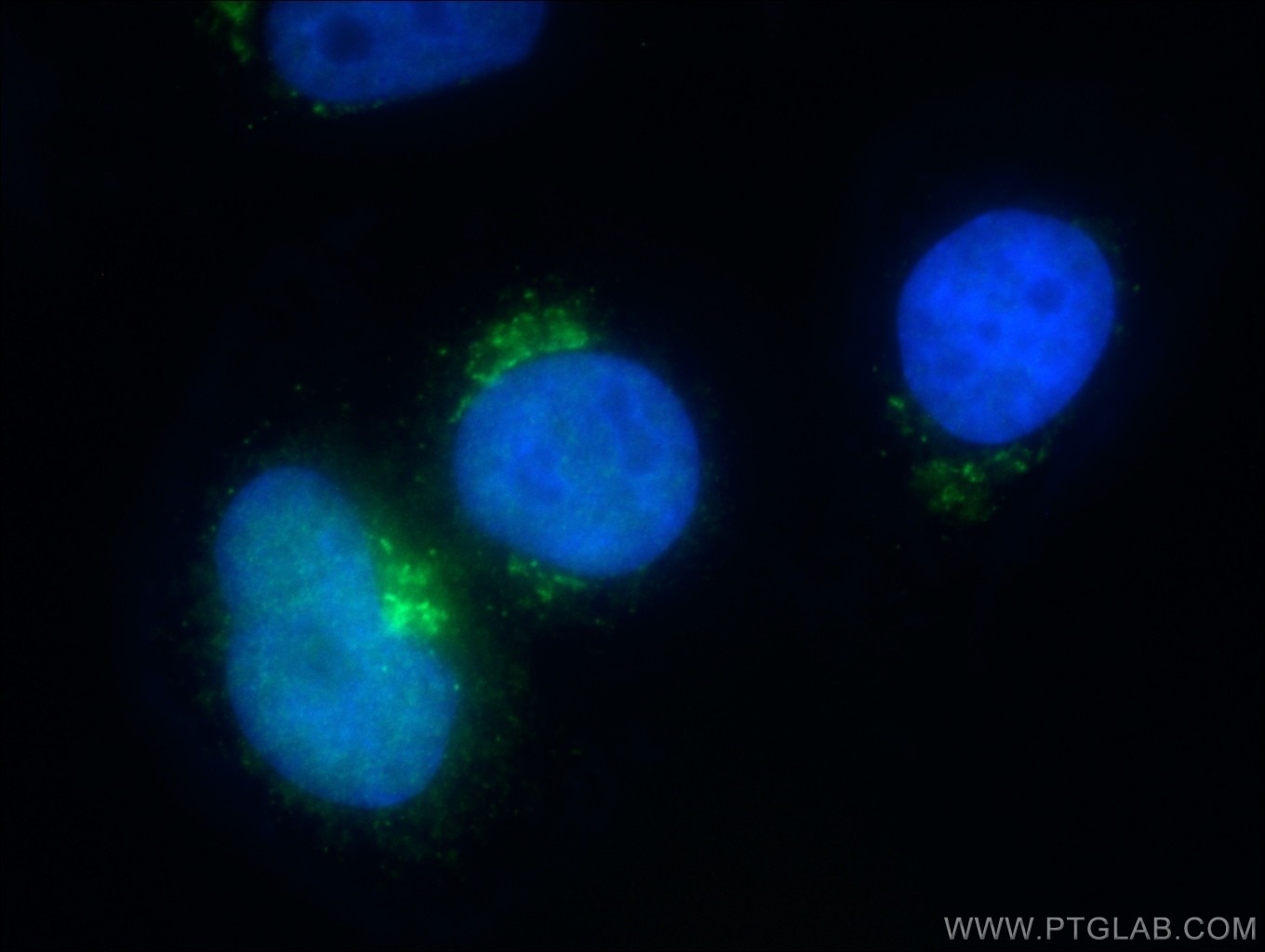Immunofluorescence (IF) / fluorescent staining of HepG2 cells using MCFD2 Polyclonal antibody (13068-1-AP)