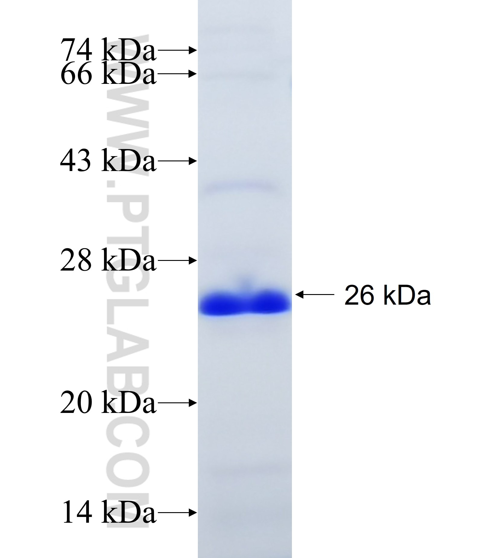 MCFD2 fusion protein Ag15276 SDS-PAGE