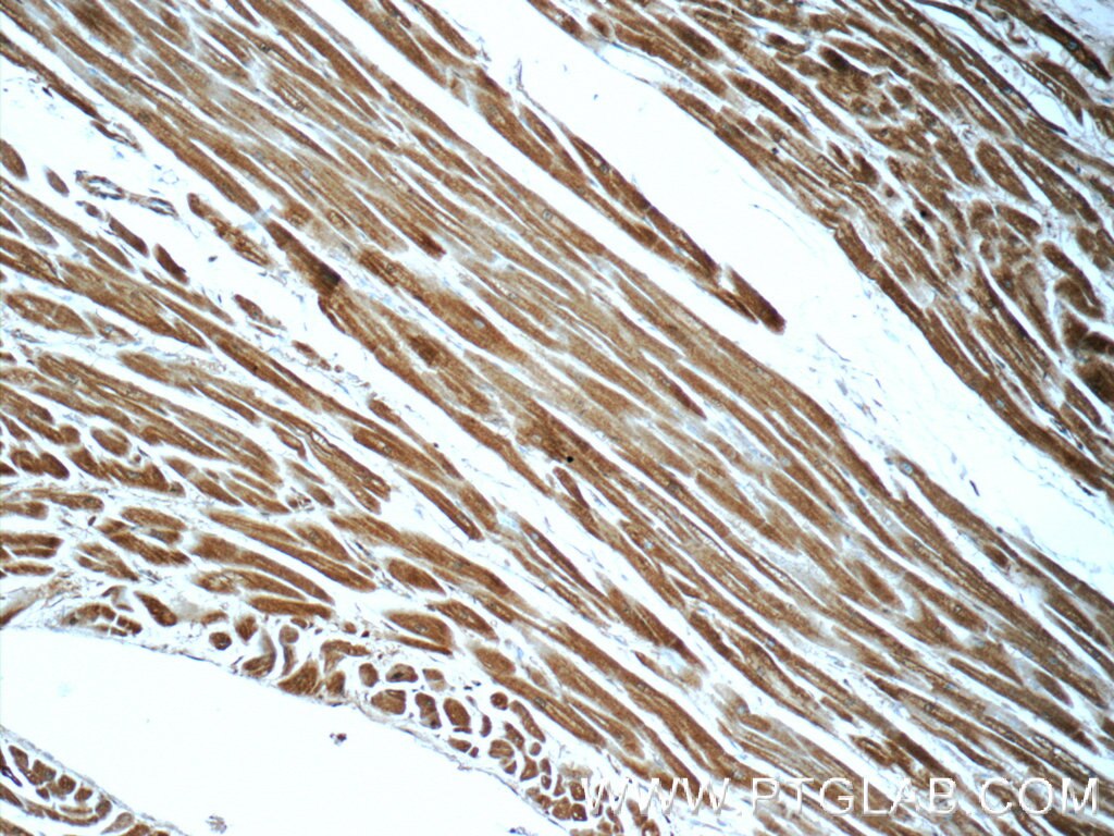 Immunohistochemistry (IHC) staining of human heart tissue using MCHR1 Polyclonal antibody (10163-1-AP)