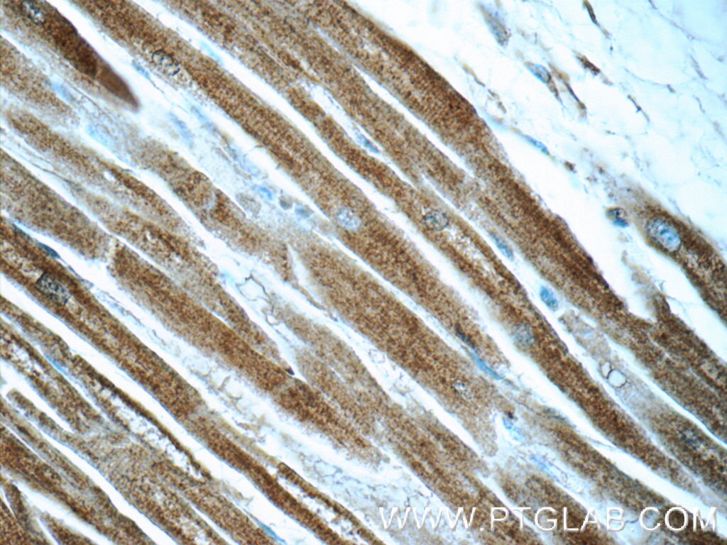 Immunohistochemistry (IHC) staining of human heart tissue using MCHR1 Polyclonal antibody (10163-1-AP)