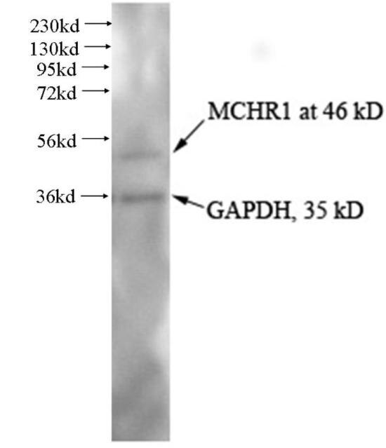 Western Blot (WB) analysis of Human anterior cingulate using MCHR1 Polyclonal antibody (10163-1-AP)