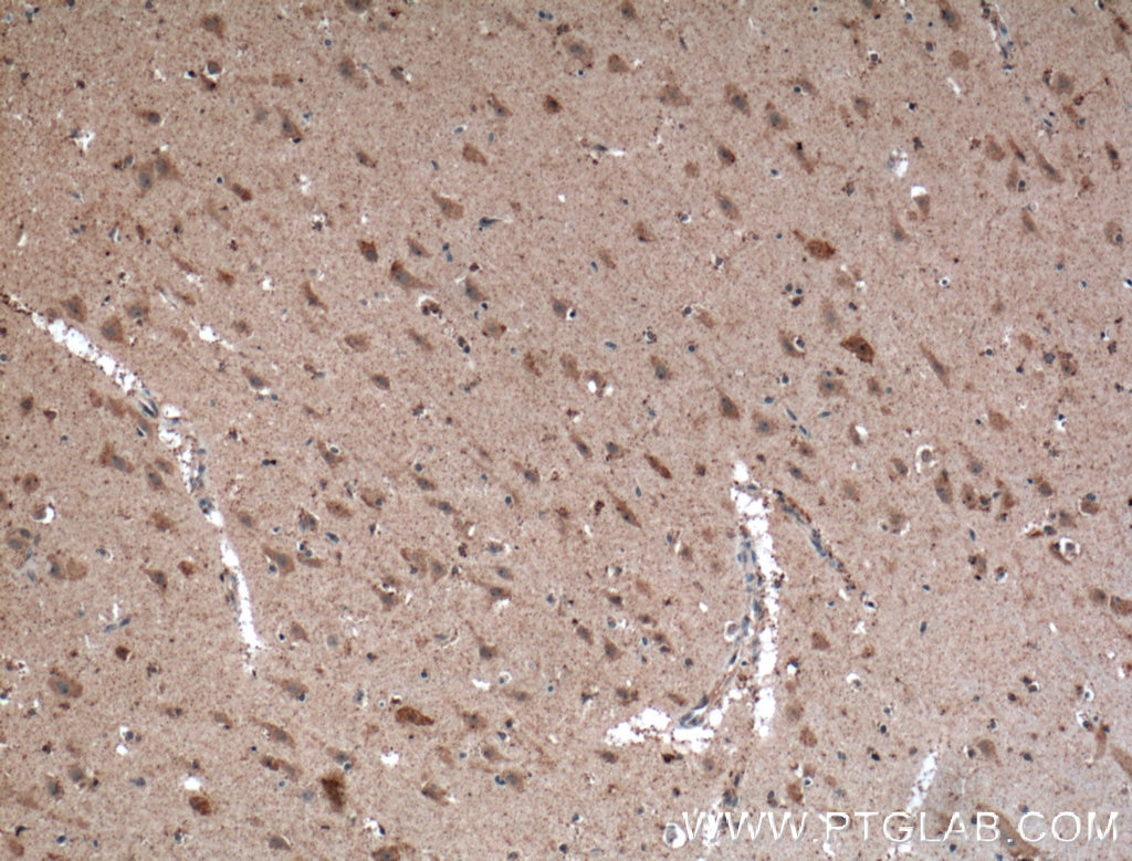 IHC staining of human brain using 11656-2-AP