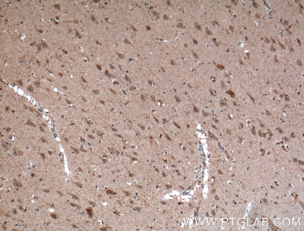 Immunohistochemistry (IHC) staining of human brain tissue using MCHR1 Polyclonal antibody (11656-2-AP)