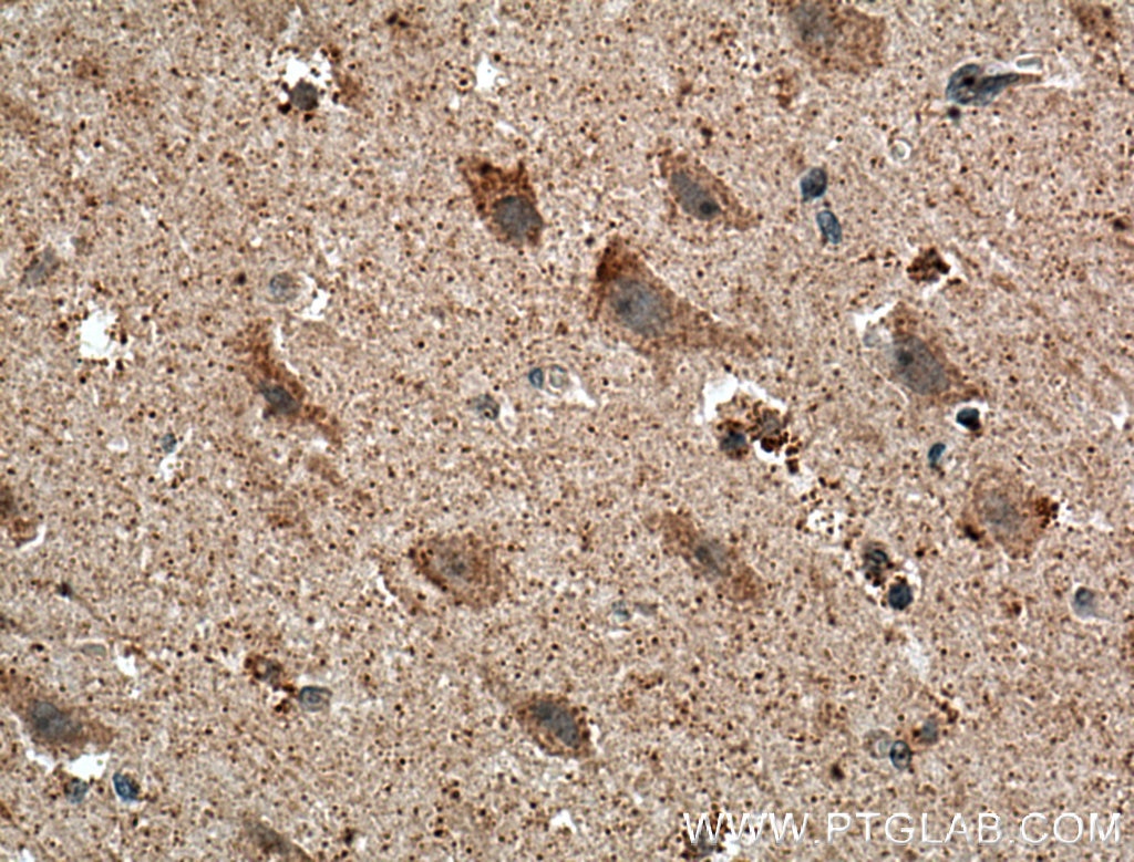 Immunohistochemistry (IHC) staining of human brain tissue using MCHR1 Polyclonal antibody (11656-2-AP)