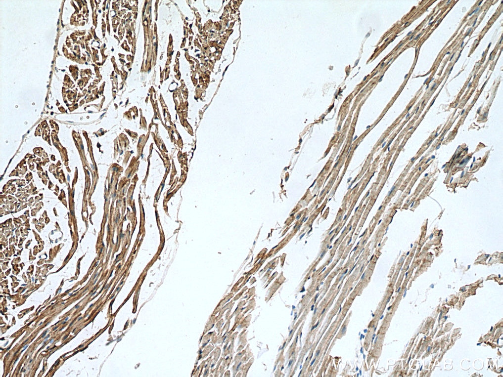 Immunohistochemistry (IHC) staining of mouse heart tissue using MCHR1 Polyclonal antibody (11656-2-AP)