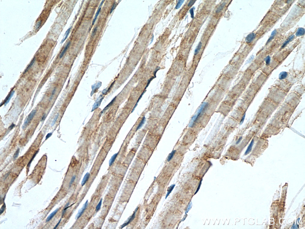 Immunohistochemistry (IHC) staining of mouse heart tissue using MCHR1 Polyclonal antibody (11656-2-AP)