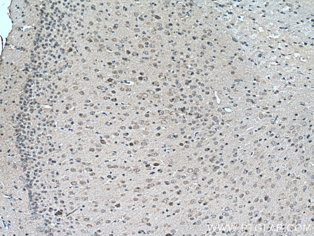 Immunohistochemistry (IHC) staining of mouse brain tissue using MCHR1 Polyclonal antibody (11656-2-AP)