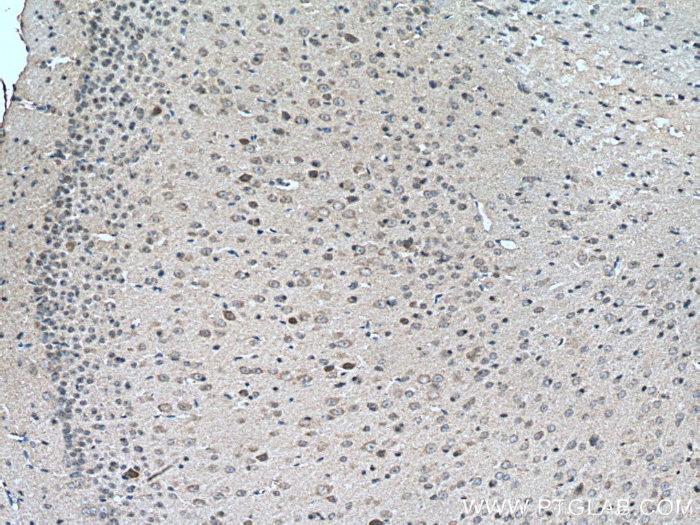 IHC staining of mouse brain using 11656-2-AP