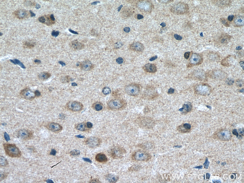 IHC staining of mouse brain using 11656-2-AP