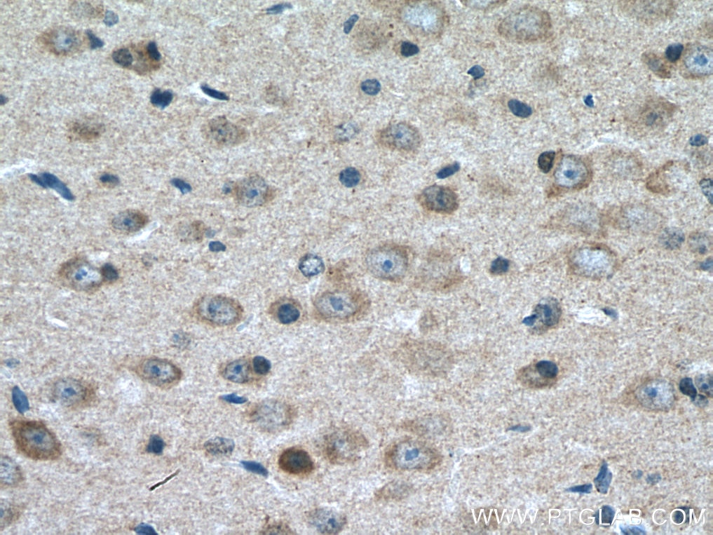 Immunohistochemistry (IHC) staining of mouse brain tissue using MCHR1 Polyclonal antibody (11656-2-AP)
