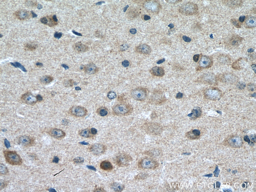 Immunohistochemistry (IHC) staining of mouse brain tissue using MCHR1 Polyclonal antibody (11656-2-AP)