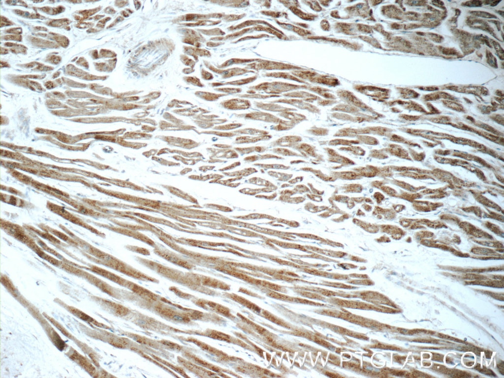 Immunohistochemistry (IHC) staining of human heart tissue using MCHR1 Polyclonal antibody (11656-2-AP)