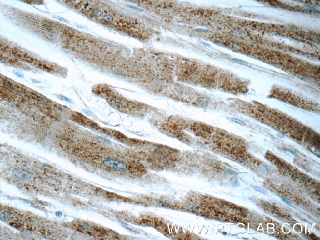Immunohistochemistry (IHC) staining of human heart tissue using MCHR1 Polyclonal antibody (11656-2-AP)