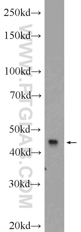 Western Blot (WB) analysis of SH-SY5Y cells using MCHR1 Polyclonal antibody (11656-2-AP)
