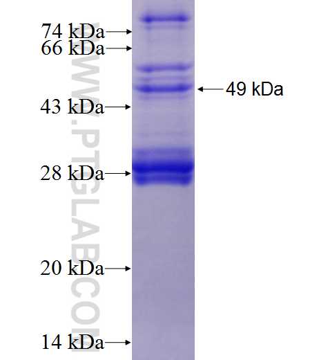 MCHR1 fusion protein Ag0177 SDS-PAGE