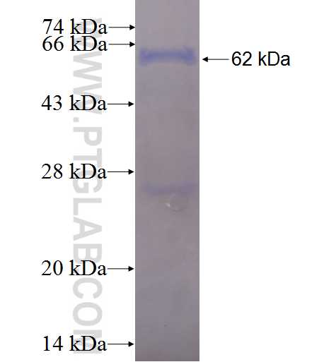MCHR1 fusion protein Ag2224 SDS-PAGE