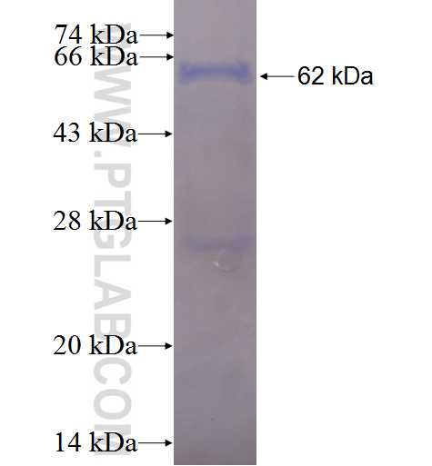 MCHR1 fusion protein Ag2224 SDS-PAGE
