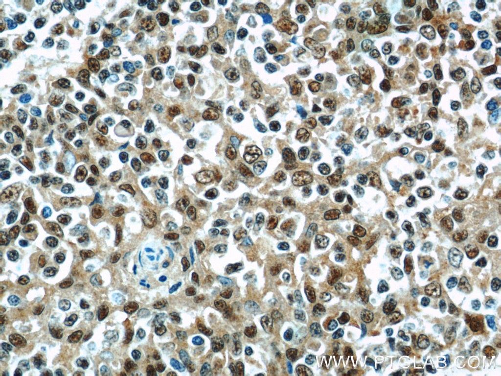 MCL1 Polyclonal antibody