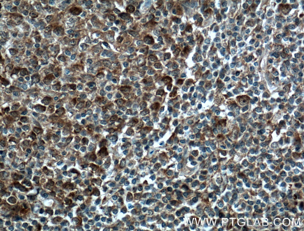 MCL1 Polyclonal antibody