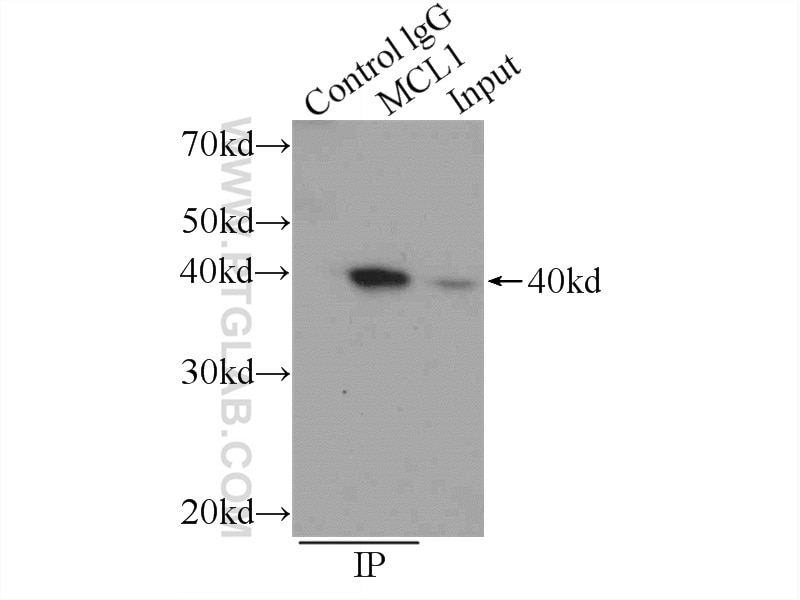 Immunoprecipitation (IP) experiment of Raji cells using MCL1 Polyclonal antibody (16225-1-AP)