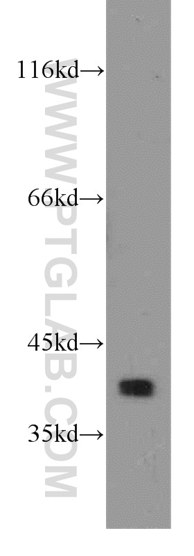 WB analysis of mouse spleen using 16225-1-AP