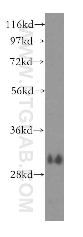 Western Blot (WB) analysis of human liver tissue using MCL1 Polyclonal antibody (16225-1-AP)