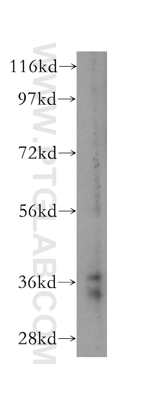 Western Blot (WB) analysis of human brain tissue using MCL1 Polyclonal antibody (16225-1-AP)