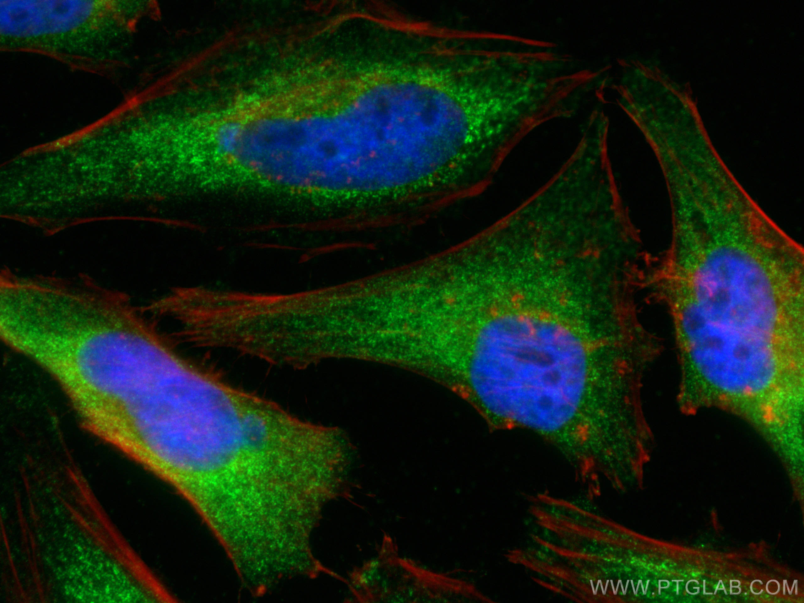 Immunofluorescence (IF) / fluorescent staining of HeLa cells using MCL1 Monoclonal antibody (66026-1-Ig)