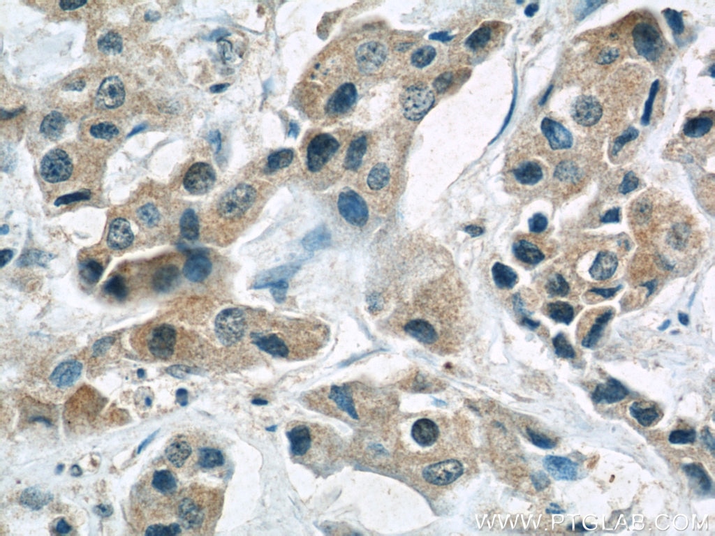 MCL1 Monoclonal antibody