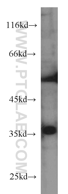Western Blot (WB) analysis of A431 cells using MCL1 Monoclonal antibody (66026-1-Ig)