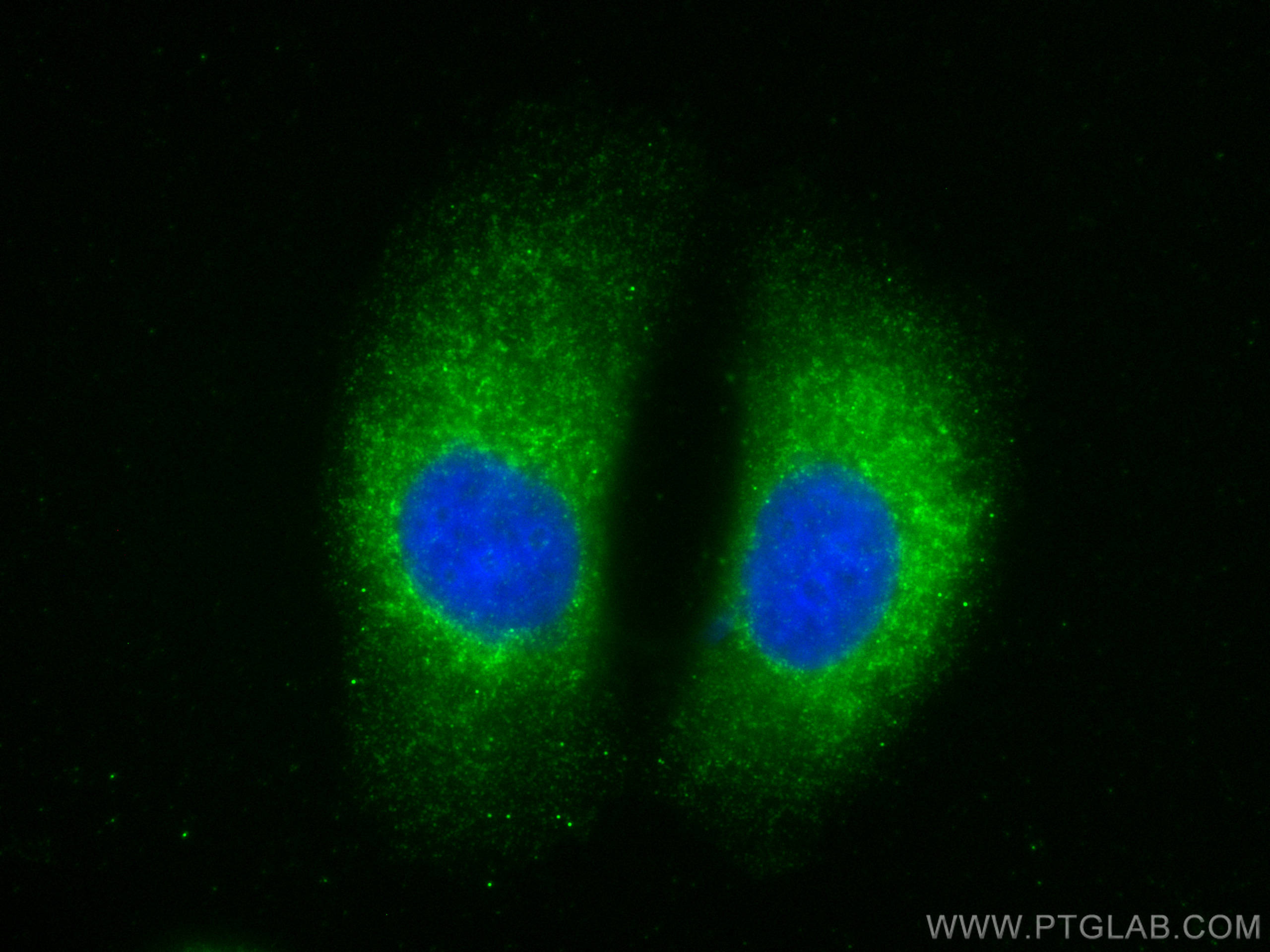 Immunofluorescence (IF) / fluorescent staining of MCF-7 cells using MCL1 Recombinant antibody (82695-2-RR)