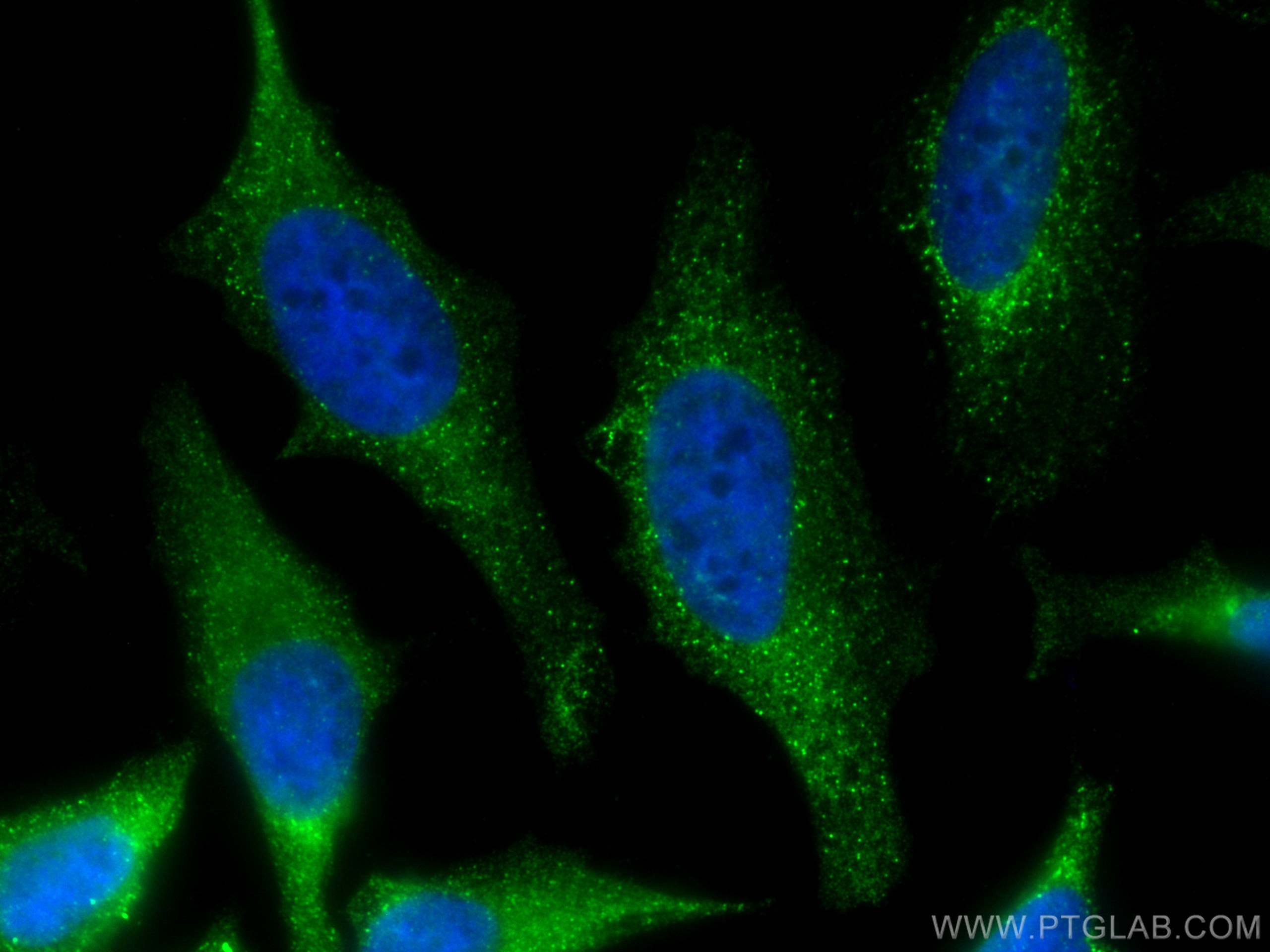 Immunofluorescence (IF) / fluorescent staining of HeLa cells using CoraLite® Plus 488-conjugated MCL1 Monoclonal anti (CL488-66026)