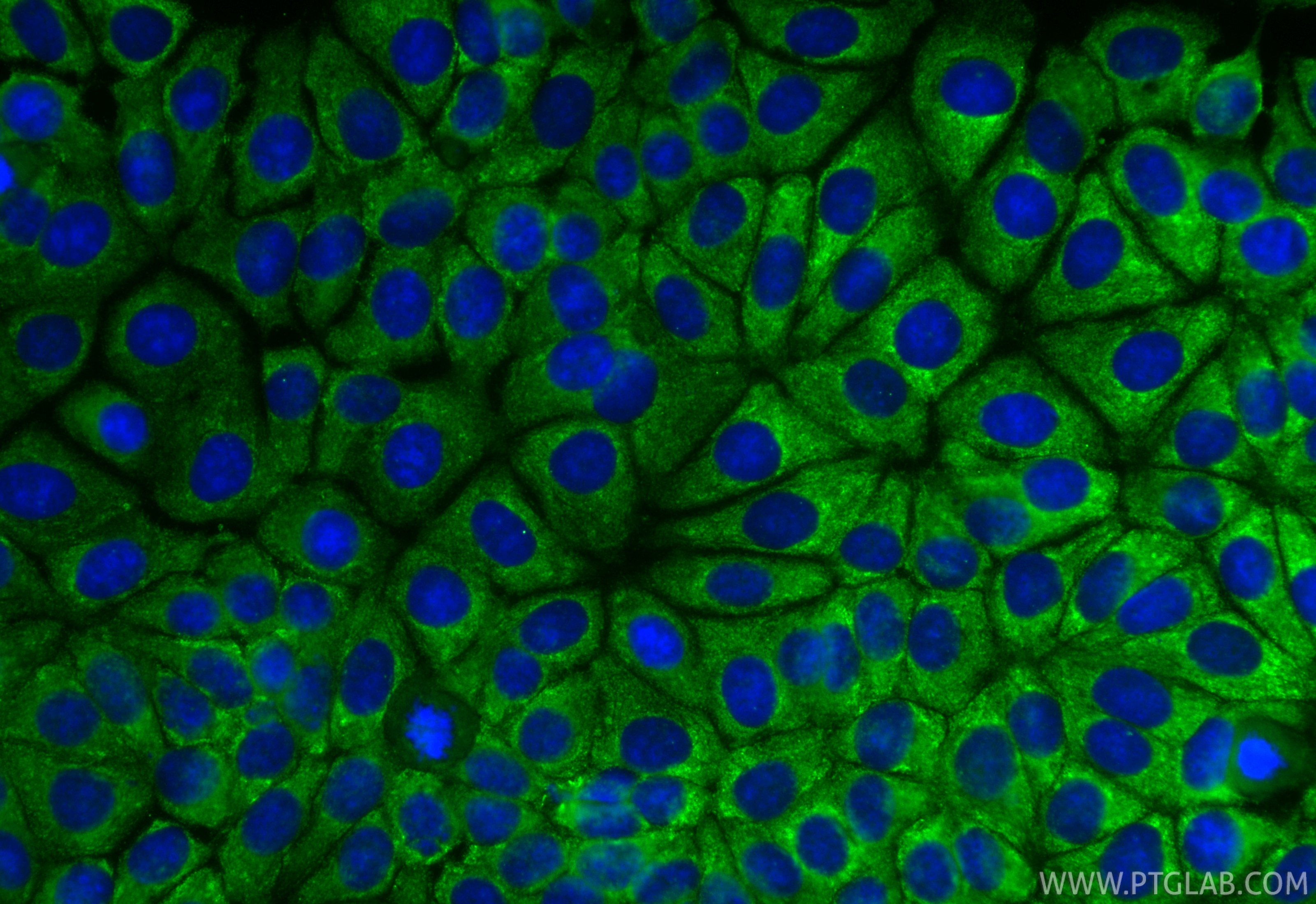 IF Staining of MCF-7 using CL488-66026 Immunofluorescence (IF) / fluorescent staining of MCF-7 cells using CoraLite® Plus 488-conjugated MCL1 Monoclonal anti (CL488-66026)