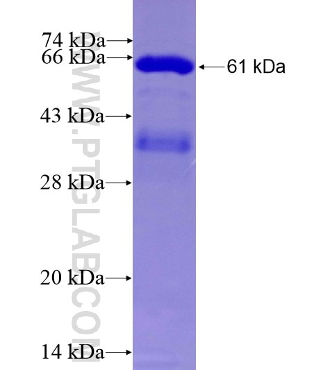 MCL1 fusion protein Ag10397 SDS-PAGE
