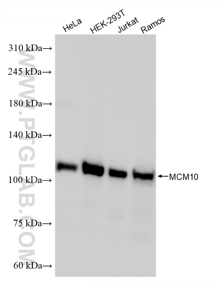 Western Blot (WB) analysis of various lysates using MCM10 Recombinant antibody (86103-1-RR)