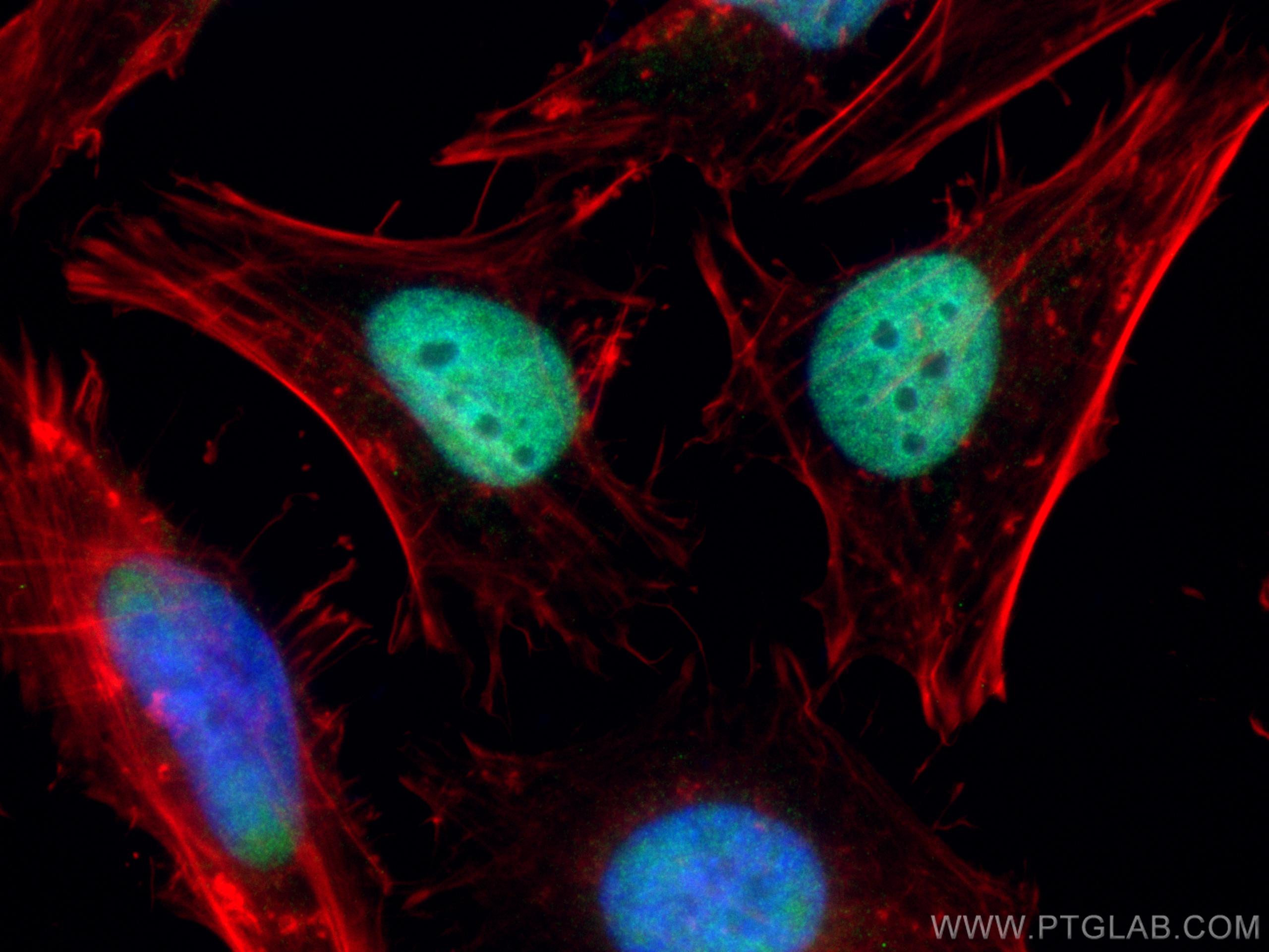 Immunofluorescence (IF) / fluorescent staining of HeLa cells using MCM2 Polyclonal antibody (10513-1-AP)