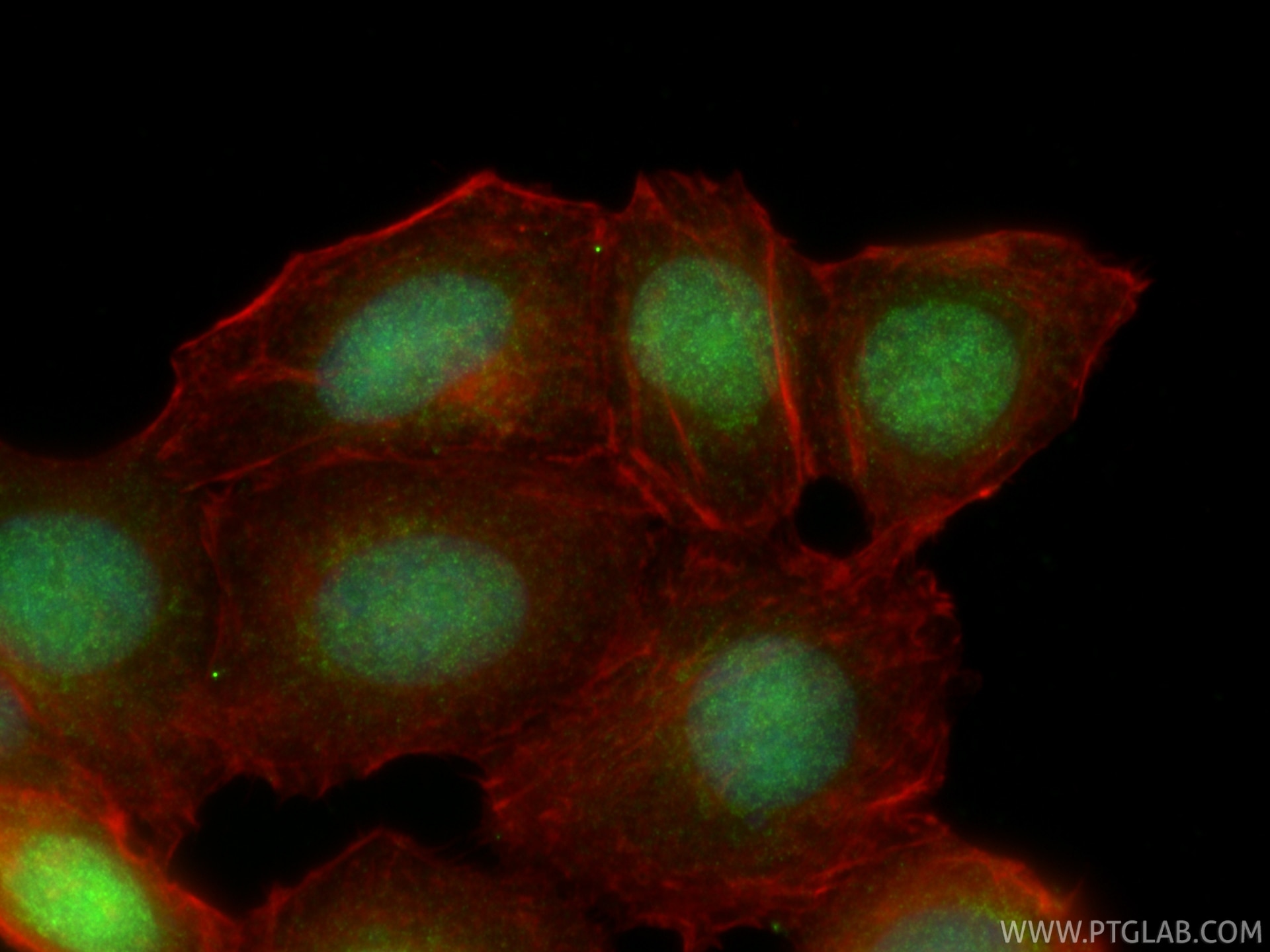 IF Staining of MCF-7 using 10513-1-AP Immunofluorescence (IF) / fluorescent staining of MCF-7 cells using MCM2 Polyclonal antibody (10513-1-AP)