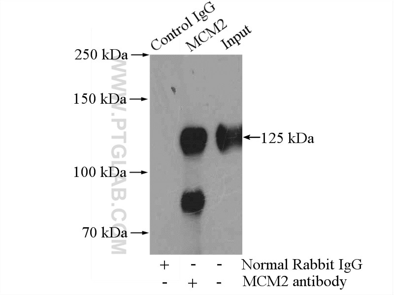 Immunoprecipitation (IP) experiment of HEK-293 cells using MCM2 Polyclonal antibody (10513-1-AP)