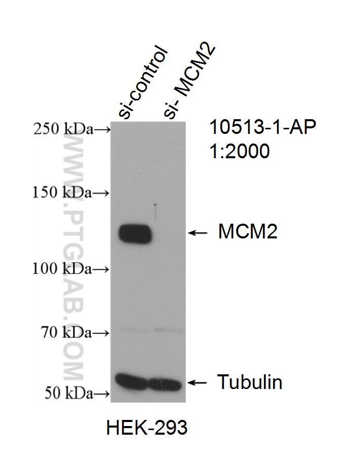 Western Blot (WB) analysis of HEK-293 cells using MCM2 Polyclonal antibody (10513-1-AP)