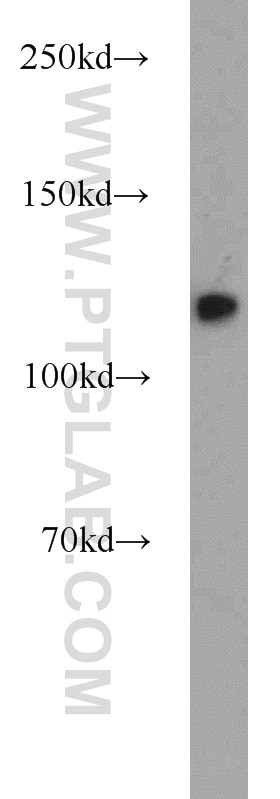 MCM2 Polyclonal antibody
